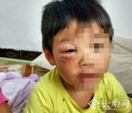 為逼離家出走的老婆回家 男子虐待4歲親生子曬朋友圈